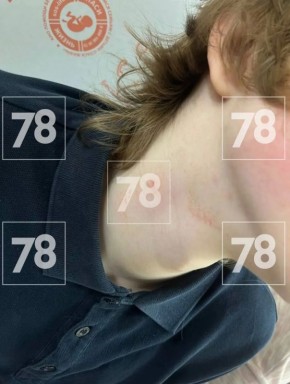 ��� ������� ����� � ������� 7 ��� ������� �� ����: �������� �� ������ ����� �������������